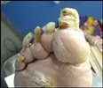 GROSS LOOKING FEET 2.jpg